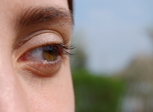 Los casos de conjuntivitis alérgica se triplican en verano