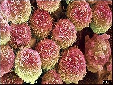 Cáncer podría tratarse con una proteína que su propio cuerpo produce 