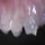 Científicos crean dientes de laboratorio los que crecen tras implantarse