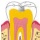 La caries dental ataca a más menores