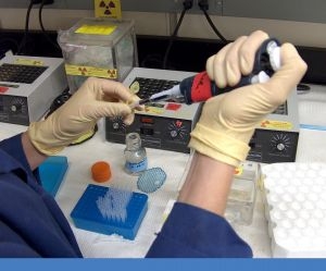 Estudio descubre el mecanismo que produce el cáncer gástrico 