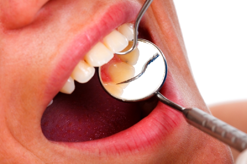 FONASA cubrirá el 40% del gasto dental de libre elección a jóvenes asegurados