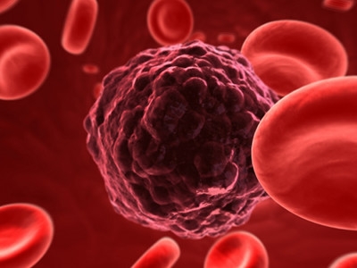 Descubren proteína que alerta el cáncer renal en sus primeras etapas