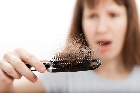 Alopecia en mujeres II