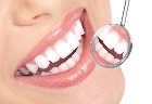 Blanqueamientos dentales: El auge del blanqueamiento dental en Chile