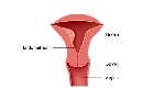 Endometriosis: Fiel enemigo de la fertilidad
