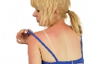 Bronceado sin protección: un peligro latente