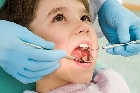 Caries en los niños