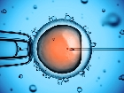 Método de Inseminación Artificial para concebir un embarazo